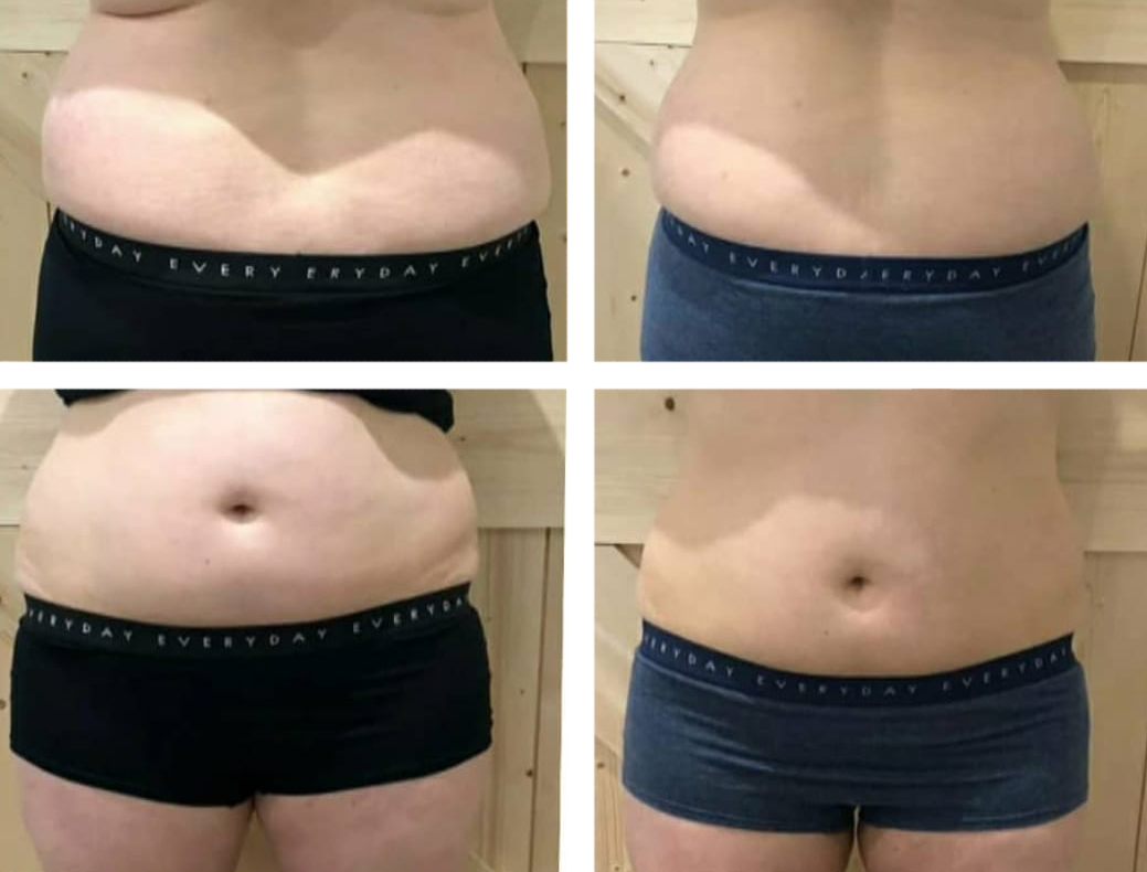 resultaten lymfopress